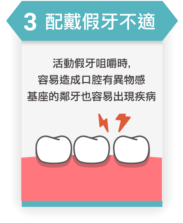 法鉑牙醫聯盟_半固定式植牙