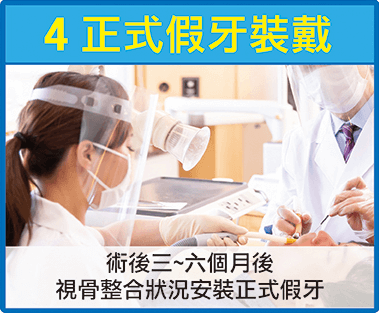 法鉑牙醫聯盟_全口重建_正式假牙裝戴