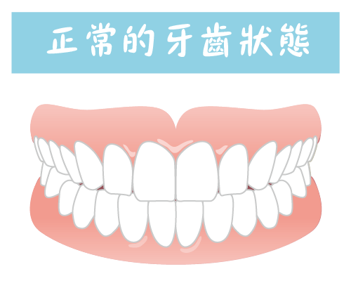 法鉑牙醫聯盟_全口重建_健康的牙齒