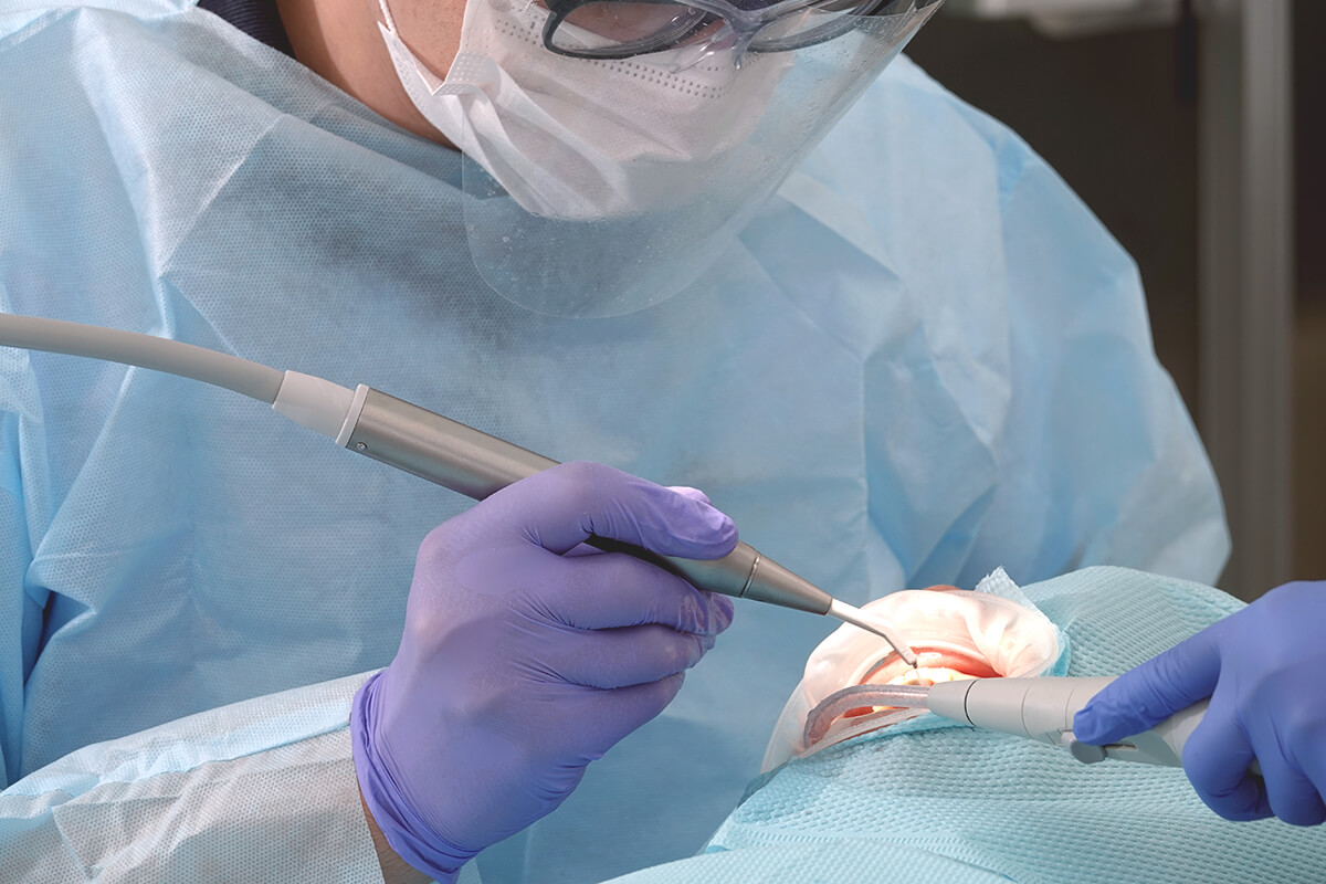 法鉑牙醫診所_自體骨移植術的優勢